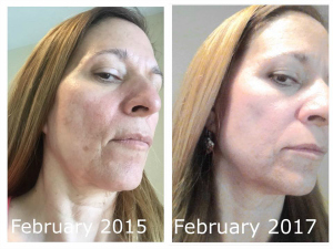Skin Care Results Skin Care Results