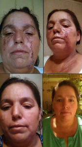 Rapid Rapair Night Cream Results Rapid Rapair Night Cream Results