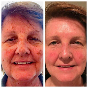 Skin Care Results Skin Care Results