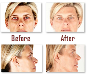 Skin Care Results Skin Care Results