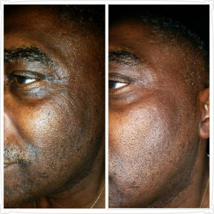 Skin Care Results Skin Care Results